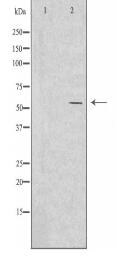 IKZF2 Antibody