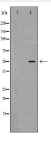 PAX3 Antibody