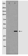 VDAC2 antibody