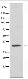 RAD Antibody