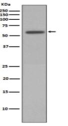 Phospho-Vimentin (S72) Antibody