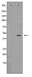 KISS1R Antibody