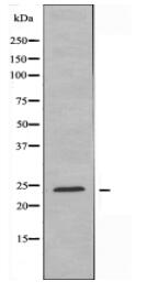MOBKL2A/B Antibody