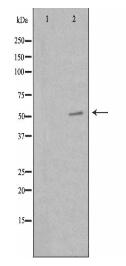 PKNOX2 Antibody