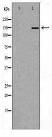 NFASC Antibody