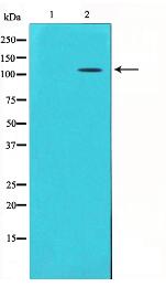 GluR5 Antibody