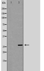 p27 Antibody