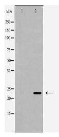 RAB7A Antibody