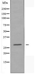 HOXD12 Antibody