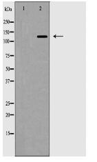 ZEB2 Antibody