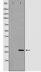 RHOC Antibody