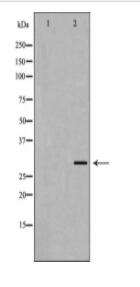 Calsenilin/KCNIP3 Antibody