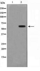 Cytochrome P450 2C19 Antibody