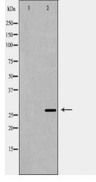 PSME1 Antibody