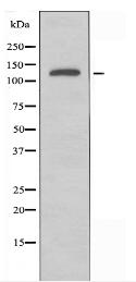 PPP1R3A Antibody