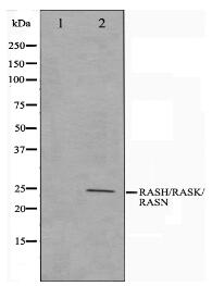 RASH/RASK/RASN Antibody