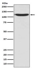 PKN2 Antibody