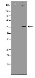 PRKG1 Antibody