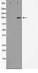 Actinin α 2/3 Antibody