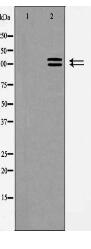 ACE2 Antibody