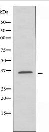 ZDHHC20 Antibody