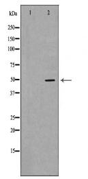 PPARD Antibody