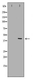 PCBP2 Antibody