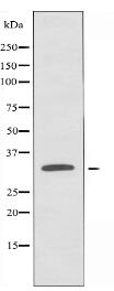 OR2T2/35 Antibody