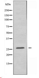 LRAT Antibody