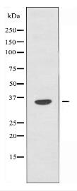 OR6C2 Antibody