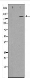 TP53BP1 Antibody