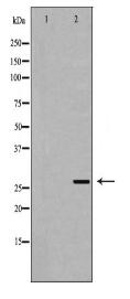TNFSF12 Antibody