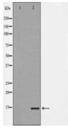 MAP1LC3A Antibody