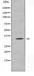 OR6C70 Antibody