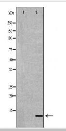 S100A8 Antibody