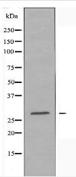RAB7L1 Antibody