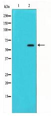 P62/SQSTM1 Antibody