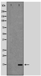 PFN1 Antibody