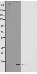 TYROBP Antibody