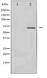 PKCB Antibody