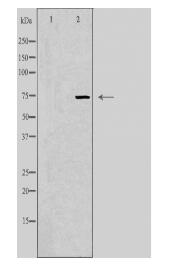 UBASH3A Antibody