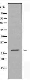 RAB6C Antibody