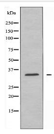 TMBIM1 Antibody