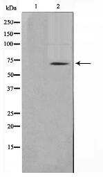 TGFR2 Antibody