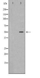 NR1H3 Antibody