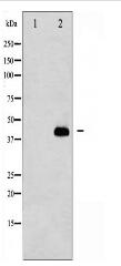 Caspase 8 (Cleaved-Asp384) Antibody