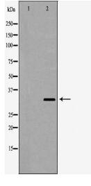 SULT2A1 Antibody