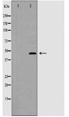 CRFR2 Antibody