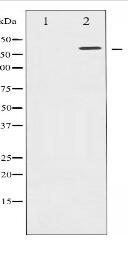 Phospho-EGFR (Thr693) Antibody