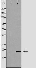 Phospho-CD3 ζ (Tyr142) Antibody